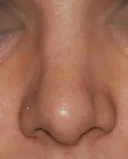 After: Broad, rounded tip