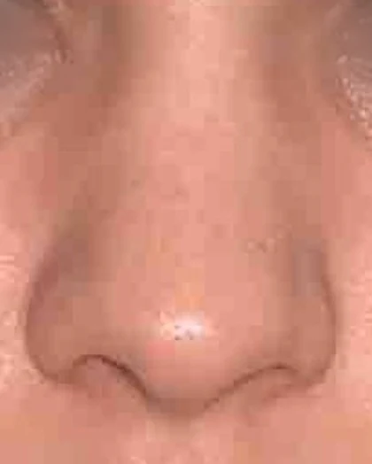 Before: Broad, rounded tip