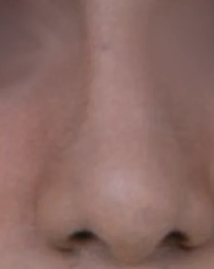 After: Broad, rounded tip