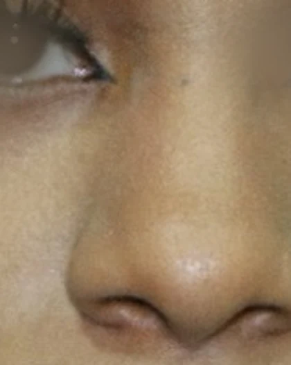 Before: Broad, rounded tip