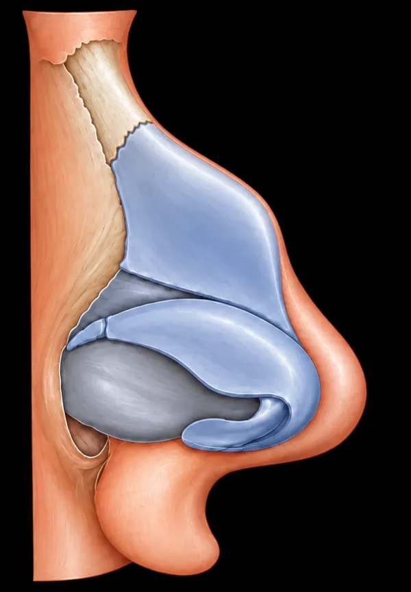 Side view illustration: hump in the upper cartilage below straight nasal bones
